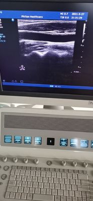 PH L12-5 医療診断 超音波線形探査機 PH HD9 対応