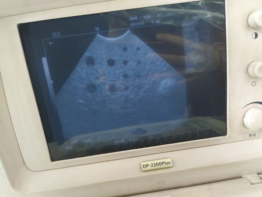 2級超音波ミンドレイ専門家妊娠スキャナー 65C15EA 画像撮影用の微積形探査機
